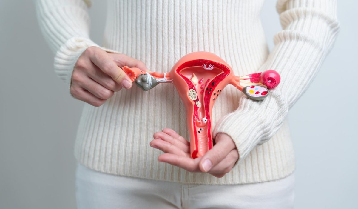 PCOS Macros